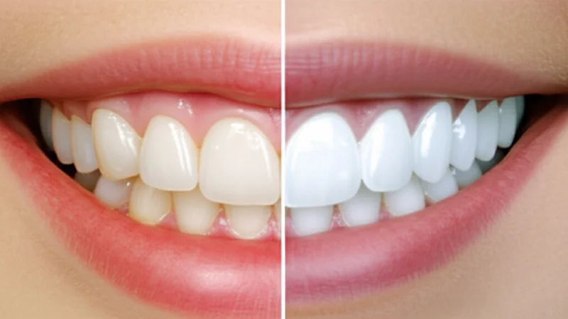 Teeth Whitening Cost in Coral Gables (2026)