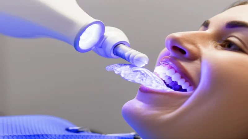Zoom vs Philips Whitening — Which is Better?